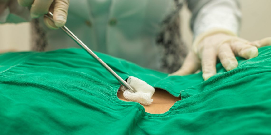 Cabedelo investe em capacitação, tecnologia e equipamentos e otimiza demandas para cirurgias eletivas no Hospital Municipal