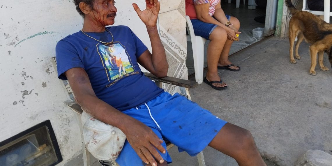 Homem com problemas psicológicos é brutalmente agredido na feira de Oitizeiro
