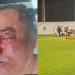 No Pará: Presidente do TRT e médico saem “no tapa” em torneio de futebol