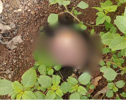 Mulher tem couro cabeludo arrancado a faca em Bananeiras; polícia investiga o caso