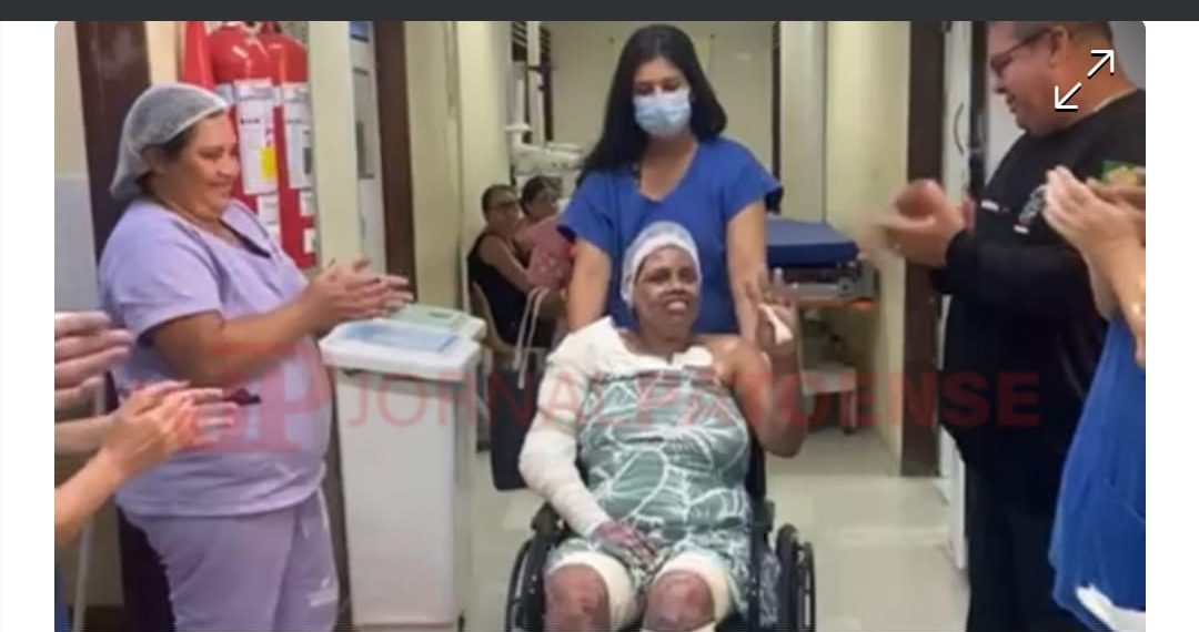 Morre mulher que teve corpo queimado ao cozinhar com álcool no Sertão da PB