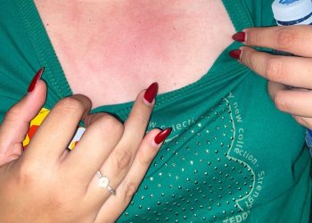 Jovem é agredida por militante da oposição em São Bento durante evento de Marcos Davi (PP) neste domingo