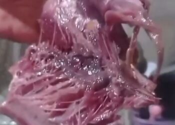 Vigilância investiga suspeita de intoxicação por peixe distribuído em ação de prefeitura