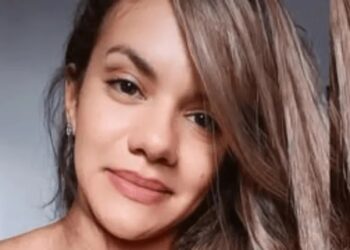 Cirurgia de reconstrução da mulher que levou 61 socos do namorado é considerada um sucesso