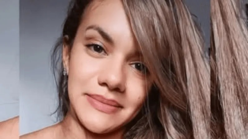 Cirurgia de reconstrução da mulher que levou 61 socos do namorado é considerada um sucesso