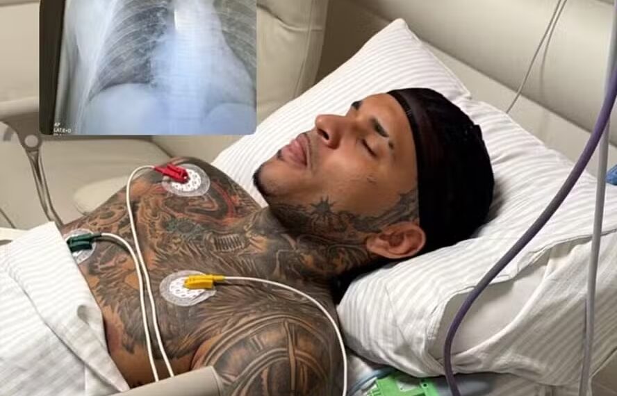 Cantor Anderson Neiff é baleado após show e passa por cirurgia em SP