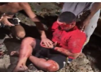 Impacto brutal: motociclista perde controle, bate em muro e tem dentes cravados na parede no Cristo