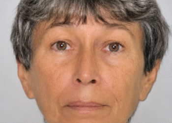 IML conclui exames e libera corpo de médica francesa assassinada em João Pessoa
