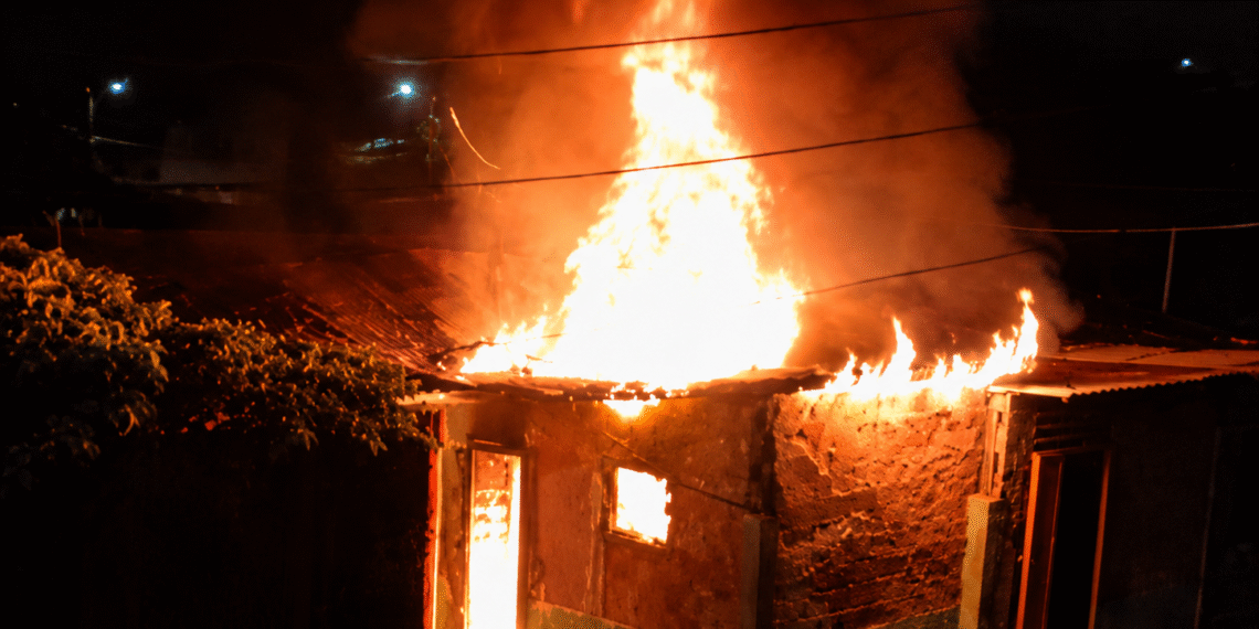 Adolescente de 15 anos sofre queimaduras em 95% do corpo após incêndio em Bayeux