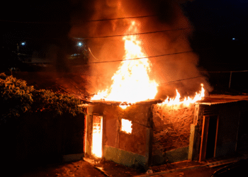 Adolescente de 15 anos sofre queimaduras em 95% do corpo após incêndio em Bayeux