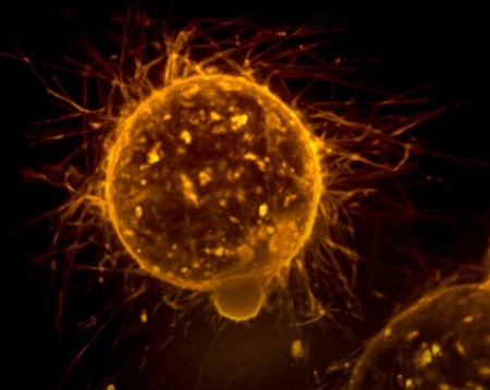 Cientistas descobrem possível forma de desativar mecanismo de progressão do câncer